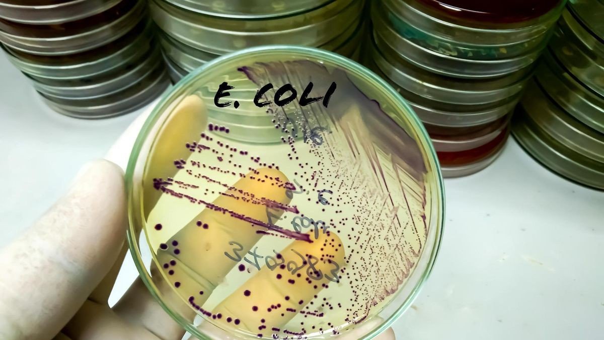 Wachstum der Escherichia coli (E. coli)-Bakterienkultur auf einer Petrischale